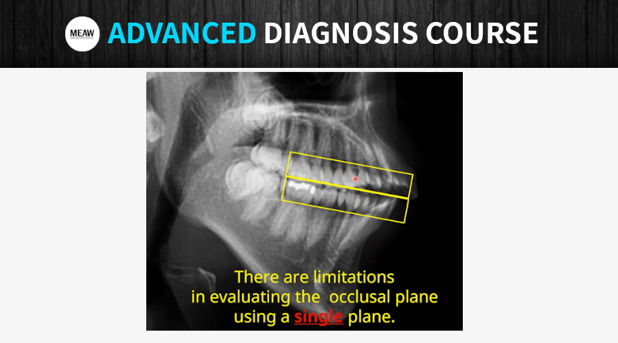 1. Introduction to Occlusal Plane