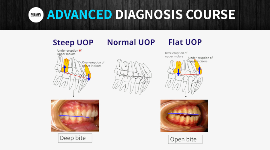 2. Occlusal Plane Analysis